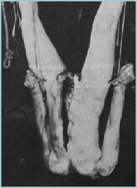 Foto de su última víctima (Bernice Worden) tomada por la policia en el momento de la inspección de su domicilio, el cadaver se encontraba decapitado y con el cuerpo completamente abierto en canal.