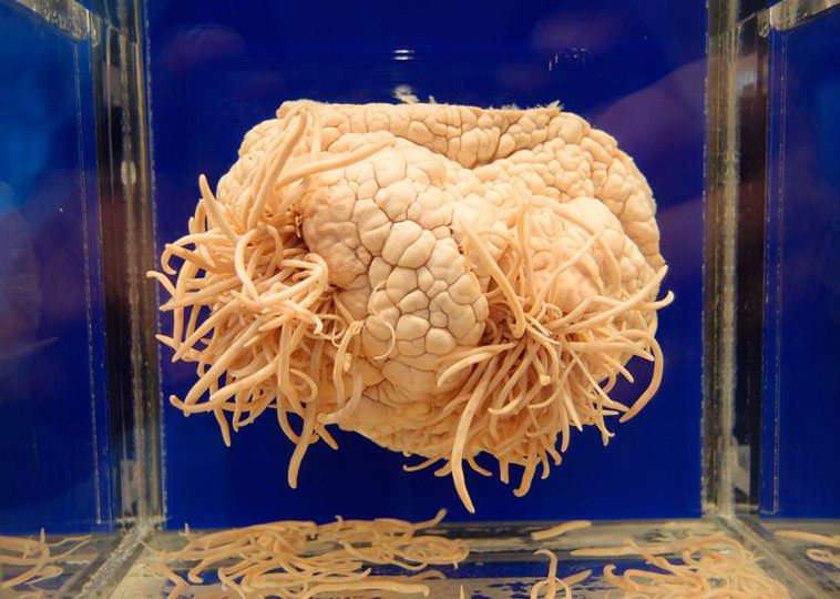 El Museo de los Parásitos