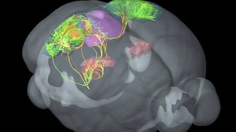 La pornografía puede ser nefasta para el cerebro
