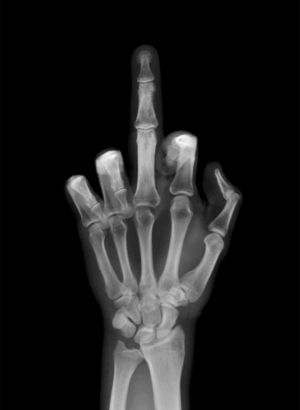 Conoce-la-historia-del-dedo-del-medio-como-gesto-obsceno-1