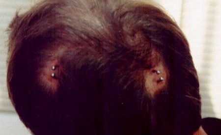 Lugares más extraños para ponerse un piercing 05