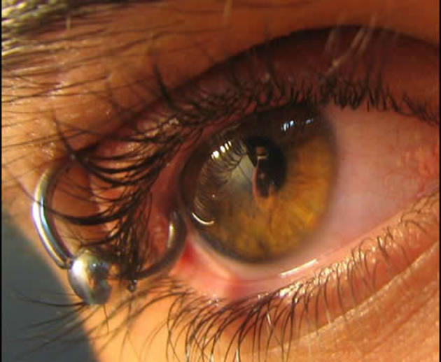 eyelid-piercing1