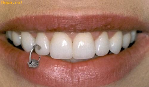 piercing-raros-diente