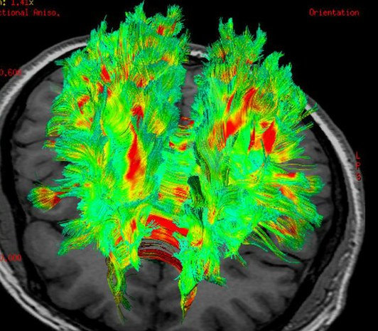 Científicos crean en laboratorio un cerebro humano