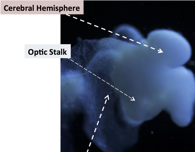 fotonoticia_20150819085936_644_000_253_000_035